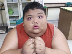 Rizki bocah obesitas